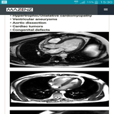mazenz.com.CardioMRI