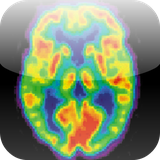 mdtoolkit.radiologycorenuclearmedicine