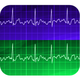 appinventor.ai_ejerciciosmatematicas_es.electrocardiogram